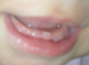 teeth-11