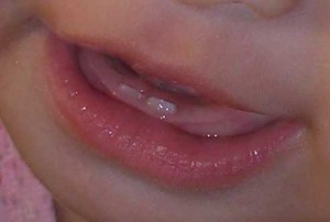 teeth-22