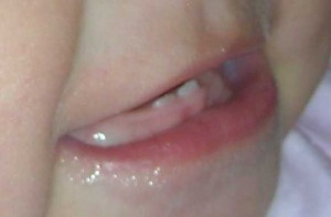 teeth-33